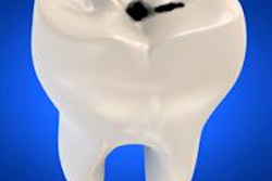 2013 04 22 17 01 11 219 000003228687 20130423000156