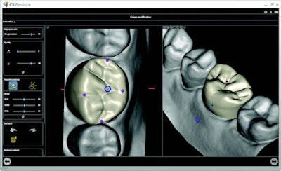 CS Restore is a CAD software module designed to simplify and automate the restoration design process.