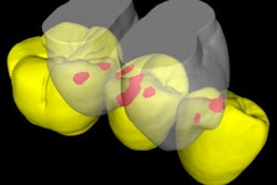 2013 04 25 11 32 18 743 2013 04 25 Collisiondetection