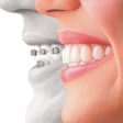 2013 05 07 10 36 39 650 Invisalign 200