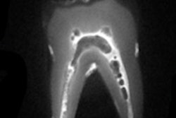 2013 05 28 13 28 34 312 Mri Swift 200