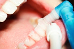 2013 07 09 14 59 02 302 Dental Polishing 200