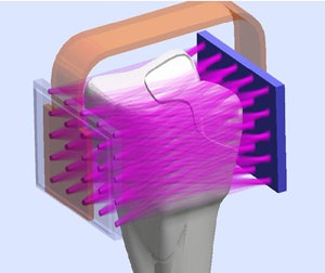 The S-Ray ultrasound device uses a process known as 'through transmission,' well-known in the world of nondestructive testing. Image courtesy of S-Ray.
