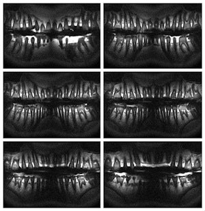 Panoramic MR images