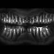 2013 08 12 14 10 16 503 2013 08 13 Mri Pan 200
