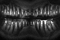 2013 08 12 14 10 16 503 2013 08 13 Mri Pan 200