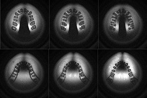 MRI of occlusal plane