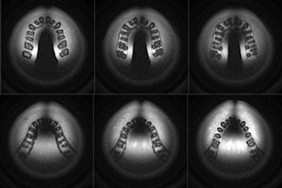 MRI of occlusal plane