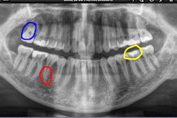 2013 09 04 12 30 47 214 Sirona Sidexis I X Figure1 250