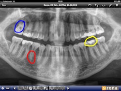 2013 09 04 12 30 47 214 Sirona Sidexis I X Figure1 250