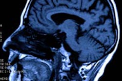 2013 10 14 13 40 00 557 Mri Head 200