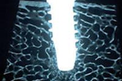 2013 10 18 10 06 46 736 Nano Bridging Surf Link 200 20131018170815