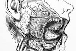 2013 04 19 11 50 16 758 Salivary Glands 200