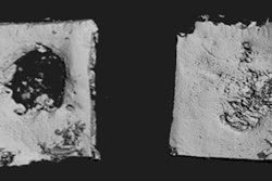 2013 11 07 17 34 53 306 2013 11 08 Bone Patch