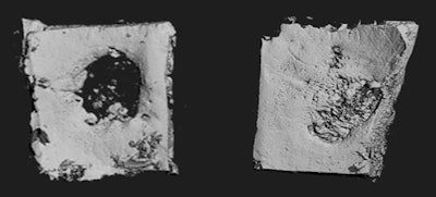 Researchers at the University of Iowa have created a bio patch to regenerate missing or damaged bone. The patch has been shown to nearly fully regrow missing skull, seen in the image above. Image courtesy of Dr. Satheesh Elangovan.
