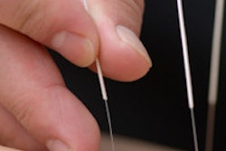 2013 12 10 15 10 18 413 Acupuncture 200