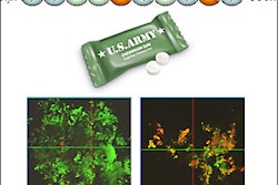 2014 01 22 11 54 41 411 Combat Gum