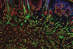2014 01 24 17 08 42 520 2014 01 27 Hnc Genes 20140125002040