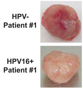 Tumors after patient HPV-negative and HPV16-positive cell lines were implanted in mice. Image courtesy of the Cancer journal.