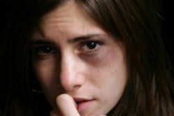 2014 03 07 17 12 17 955 Domestic Violence Abuse 200