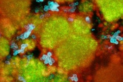 2014 03 13 14 07 27 637 2014 03 13 Bacterium Fungus