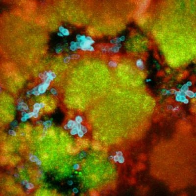 This figure (a cross section of the biofilm) depicts S. mutans microcolonies (in green) together with C. albicans (in blue) all surrounded and enmeshed in extracellular polysaccharides matrix (in red). Image courtesy of Hyun (Michel) Koo, University of Pennsylvania.