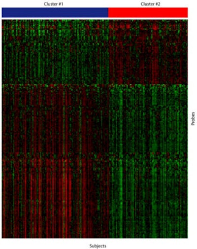 By looking at the expression of thousands of genes in periodontal tissue, researchers can now classify most cases of periodontitis into one of two clusters. More severe cases of the disease are represented under the red bar, less severe cases under the blue bar. The findings may allow for earlier diagnosis and more personalized treatment of severe periodontal disease, before irreversible bone loss has occurred. Image courtesy of Panos Papapanou, DDS, PhD, Columbia University College of Dental Medicine.