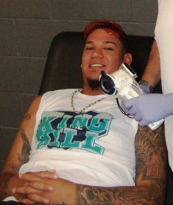 Mariners pitcher Felix Hernandez prepares for his screening with the VELscope Vx. Image courtesy of DenMat.