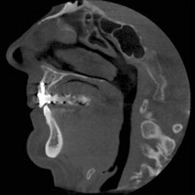 2017 08 09 20 29 13 26 Cbct Thumb 400