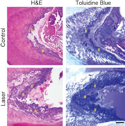 The team used high-resolution x-ray imaging and microscopy techniques to assess the formation of reparative (tertiary) dentin 12 weeks after the low-power laser treatment. In the microscopy images shown here, the yellow hashtags (#) sit atop the newly formed tertiary dentin; there is more tertiary dentin in the laser-treated teeth than in the control. Image courtesy of the Wyss Institute and SEAS.