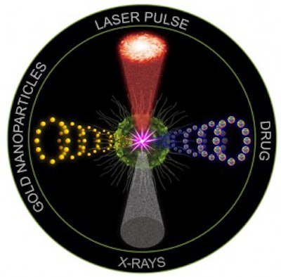 The first preclinical study of the anticancer technology 'quadrapeutics' found it to be 17 times more efficient than conventional chemoradiation therapy against aggressive, drug-resistant head and neck tumors. Image courtesy of Dmitri Lapotko, PhD, and Ekaterina Lukianova-Hleb, PhD.