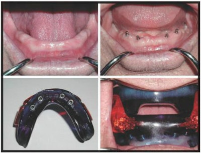 Image courtesy of Sleep Group Solutions.