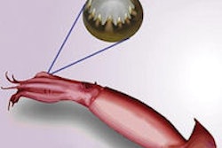 2014 07 09 15 04 13 399 2014 07 10 Squid Thumb