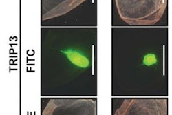 2014 08 04 11 05 23 779 2014 08 04 Protein Cancer Cell Repair