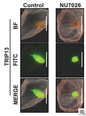 Left column: Untreated head and neck cancer cells are tagged fluorescent green. Right column: Shows cells treated with the chemical inhibitor that blocks TRIP13, which results in a dramatically smaller tumor. Image courtesy of Rajat Banerjee.