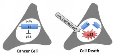 Using a gene editing method known as CRISPR, Duke researchers were able to selectively destroy two viral genes responsible for the growth and survival of cervical carcinoma cells, causing the cancer cells to self-destruct. Image courtesy of Bryan Cullen, PhD.