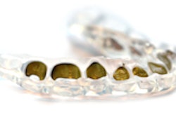 2014 09 18 16 03 33 763 3 M Unitek Incognito Tray 200
