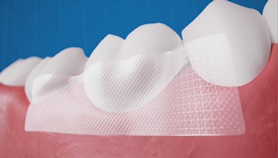 The strips are designed to cover the outer gumline of sensitive teeth.