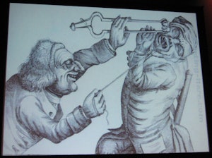 In the 1600s and 1700s, dentists held tongs with burning coals against the faces of their patients to distract them while doing extractions. Image courtesy of Patrick Sammon, PhD.