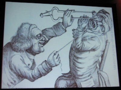 In the 1600s and 1700s, dentists held tongs with burning coals against the faces of their patients to distract them while doing extractions. Image courtesy of Patrick Sammon, PhD.