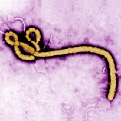 2014 10 15 13 54 29 563 Ebola 200