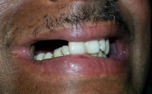 Before