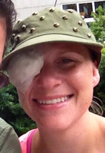 Morrone this summer with her eye patch. All images courtesy of Jenn Morrone.