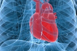 2014 07 21 16 18 37 990 Human Heart 200