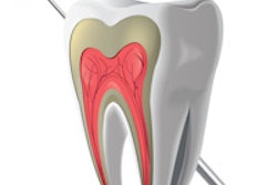 2014 11 04 17 26 15 349 Tooth Pulp Endodontic 200