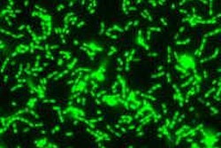 2014 11 19 17 01 34 371 Streptococcus Mutans 200