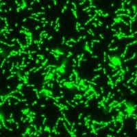 2014 11 19 17 01 34 371 Streptococcus Mutans 200