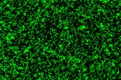 2014 11 19 17 01 36 596 2014 11 20 Mucins3