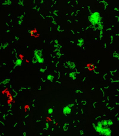 2014 11 19 17 01 37 850 2014 11 20 Mucins2 200