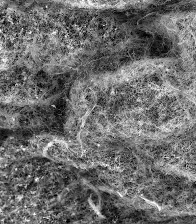 2014 11 19 17 01 39 988 2014 11 20 Mucins